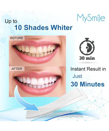 MySmile Teeth Whitening Kit | 14 Sets Strips & 3 Gel Lights | Fast Whitening, Reduced Sensitivity | Remove Stains from Coffee, Wine & Smoking - Buy Online on SooperMarket.com