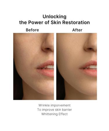 Buy Peptide 11 Botulinum Multi Recovery Ampoule 30ml - Anti-Aging Skin Treatment for Global Shipping - Buy Online on SooperMarket.com