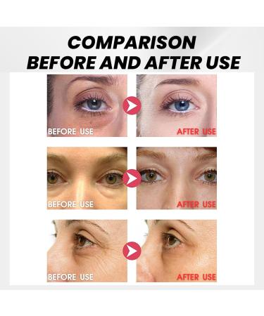 Eye Tightening Cream Instant Instant Firming Eye Cream for Dark Circles and Puffy Eyes Eye Firming Cream Instant Eye Bag Cream Under Eye Cream for Eye Bag Remover Anti Aging Fine Lines 15ml - Buy Online on SooperMarket.com