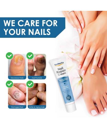 Extra Strength Toenail Fungus Treatment Cream for Thick, Broken, Discolored Nails - 1 Count - Buy Online on SooperMarket.com