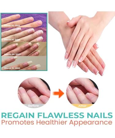 Vitamin Nail Strengthening Cuticle Oil with dropper For Fingernail Or Toenail Nail Strengthener Oil For Damaged And Weak Nails 15ml Orange+Lavender+Green tea - Buy Online on SooperMarket.com
