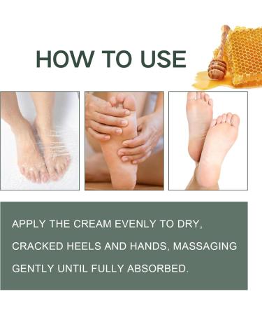 Foot Cream for Cracked Heels and Dry Skin Feet Hard Skin Remover Foot Moisturiser Callus Remover for Feet Nourishes Feet & Hand Foot Care Cream to Improve Elasticity & Smoothen Skin - Buy Online on SooperMarket.com
