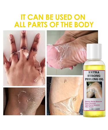 Yellow Peeling Oil for Dark Skin - Strong Extra Strength Exfoliating Solution with Salicylic Sodium Hyaluronate - 110ML/3.66 OZ - Buy Online on SooperMarket.com