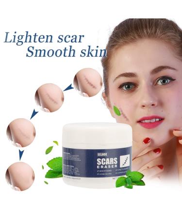 Scar Gel - Skin Repair and Removal Treatment for Face, Body, Surgery, Burns, Stretch Marks - Buy Online on SooperMarket.com