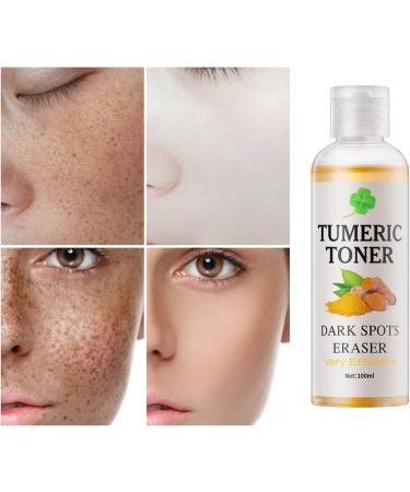 Turmeric Dark Spot Corrector Toner 4oz - Facial Toner for Acne Prone Skin - Hydrating Dark Spot Remover for Women - Hyperpigmentation Treatment for Dry Oily Skin - Buy Online on SooperMarket.com