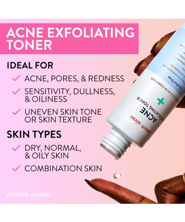 Peach Slices Acne Exfoliating Toner - 2% Salicylic Acid, AHA+BHA Exfoliation - Calming, Breakout Prevention - Alcohol & Sulfate Free - 4 Oz - Buy Online on SooperMarket.com