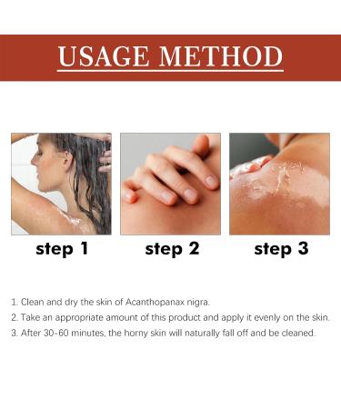 Extra Strong Peeling Oil - Chemical Exfoliant for Face & Body | Reduces Wrinkles Stretch Marks & Dead Skin - Buy Online on SooperMarket.com