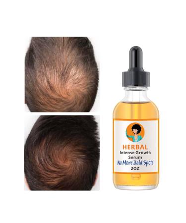 Hair Growth Oil for Women Men  Hair Growth Serum Oil with Tumeric  Hair Thickening Products for Women  Hair Strengthening Oil Hair Treatment for Split Ends Dry Scalp Hair Growth for Fast Results -2OZ