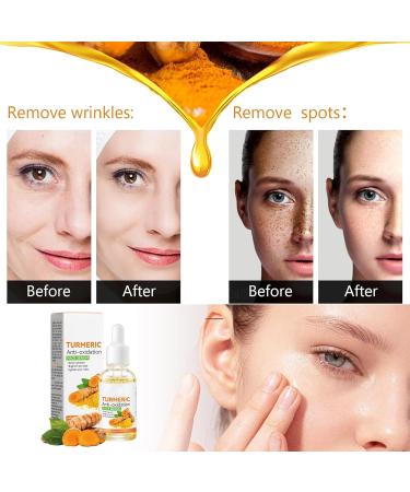 Turmeric Serum Dark Spots 30 ml Spot Corrector Face & Body Anti Aging and Wrinkle Face Serum Reduces Hyperpigtation Age Spots Sun Spot Improve Skin Tone Moisturize Brighten All Types - Buy Online on SooperMarket.com