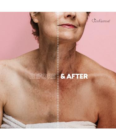 Just Nutritive Anti-Aging Body Treatment | Moisturizer for Youthful Skin | Body Oil with Anti-Aging Benefits - 8 Fl Oz - Buy Online on SooperMarket.com