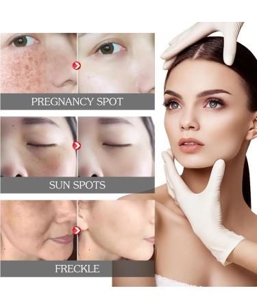 Dark Spot Remover for Face Hyaluronic Acid Dark Spot Correcting Serum Anti Aging Face Serum for Women Nicotinamide Dark Spot Correcting Glow Serum Anti Spot Face Serum and Oil Skin Moisturizer-30ml - Buy Online on SooperMarket.com