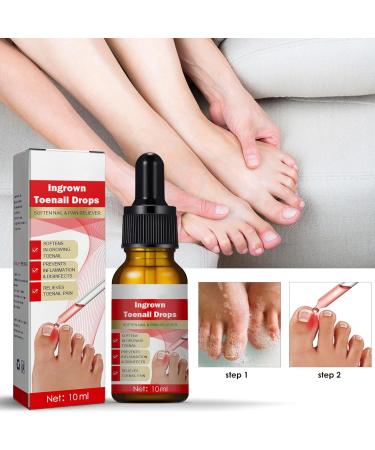 Ingrown Toenail Treatment Nail Growth Ingrowing Toenail Treatment Nail Helper Fungal Nail Treatment Correction Oil Drops Ingrown Toenail Corrector Toe Nail Fungus Treatment Cuticle Oil - Buy Online on SooperMarket.com
