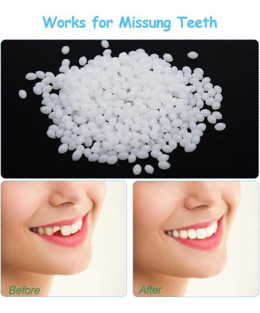 Cailong Instant Veneers & Whitening Kit - 4 Pairs for Snap-On Temporary Tooth Covering & Filling - Sensitive Teeth Friendly - Buy Online on SooperMarket.com