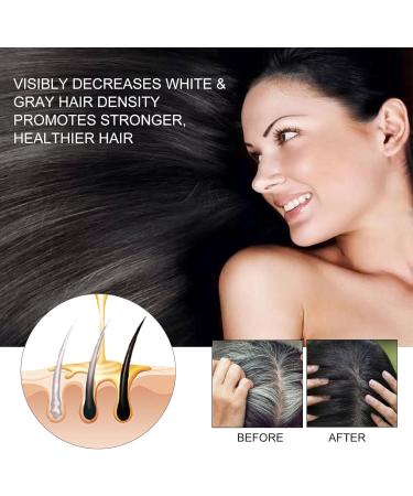 Nmbol Hair Growth Spray 1 - Buy Online on SooperMarket.com