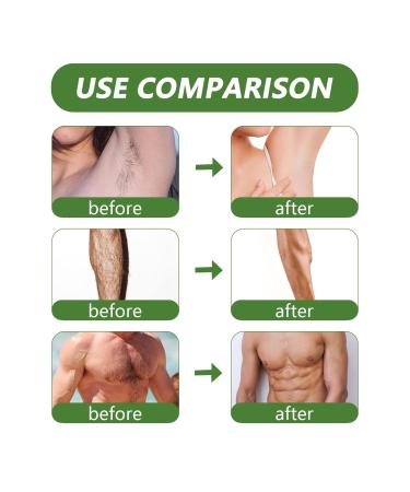 Pain-Free Pearl Wax for Hair Removal | Aloe Vera Hard Wax Pearls for Sensitive Skin Perfect for Bikini Legs Arms & More - Buy Online on SooperMarket.com