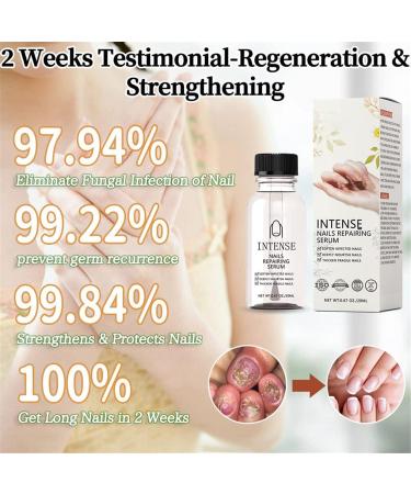 NailGro Intense Nail Growth and Strengthening Serum 7 Days Nail Growth and Strengthening Serum Natural Nail Repair Serum for Thin Nails and Growth 20ml (2Pcs) - Buy Online on SooperMarket.com