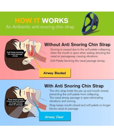 Anti-Snore Chin Strap for Men and Women - Stop Snoring with Comfort - Buy Online on SooperMarket.com