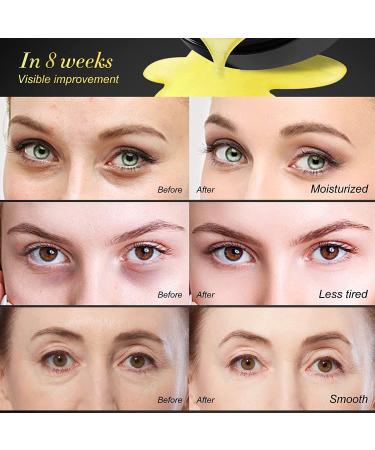 24K Gold Eye Masks - Collagen Under Eye Treatment Patches for Puffy Eyes, Dark Circles, Anti-Wrinkle - 30 Pairs - Buy Online on SooperMarket.com