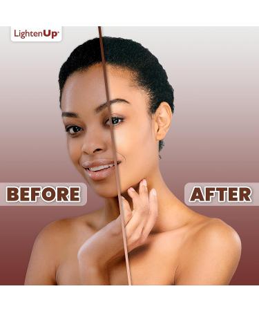 LightenUp Lactic Acid Cream 1.7 fl oz - Skin Brightening AHA Cream with Vitamin C & Shea Butter - Fade Dark Spots on Body - Buy Online on SooperMarket.com