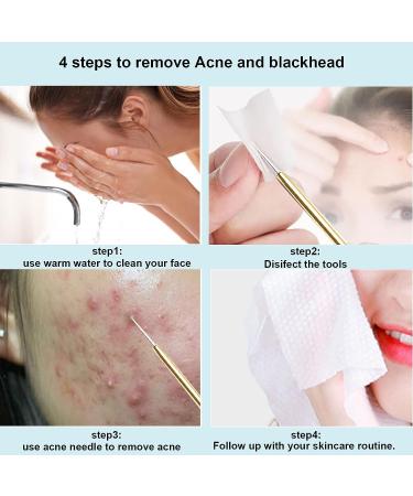 Blackhead Remover Kit - 2 PCS Pimple Popper Tool for Face & Nose | Blackhead & Whitehead Removal Treatment Tool - Blemish & Acne Extractor Set - Buy Online on SooperMarket.com