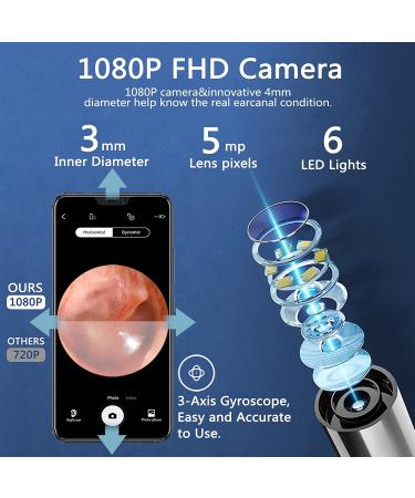Rocason White Ear Wax Removal Tool Camera - WiFi Connected 1080P HD Otoscope for Kids and Adults - Ear Cleaning Endoscopic Camera for iPhone, iPad, Android Phones - Buy Online on SooperMarket.com