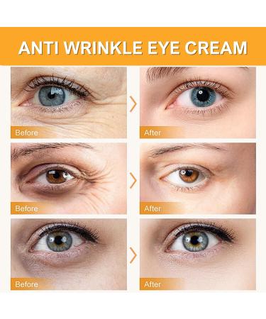 Turmeric Eye Cream Anti Aging Eye Cream With Vitamin C Eye Cream For Dark Circles And Puffy Eyes Turmeric Cream For Radiant&Glowing Skin Under Eye Cream Dark Circle Eye Cream All Skin Types - Buy Online on SooperMarket.com