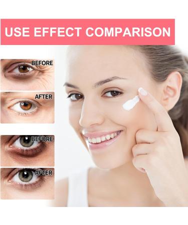 Eye Stick Reduces Wrinkles Saggy Skin Puffy Eyes Retinol Eye Cream for Dark Circles Puffiness Under Eye Bags Fine Lines Wrinkles - Buy Online on SooperMarket.com