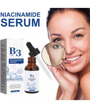 Nmbol Niacinamide Serum for Face Niacinamide Serum Anti-Aging Facial Essence Reines 5% Niacinamide Vitamin B3 & Hyaluronic Acid Pkin brightening essence for fading dark spots. - Buy Online on SooperMarket.com