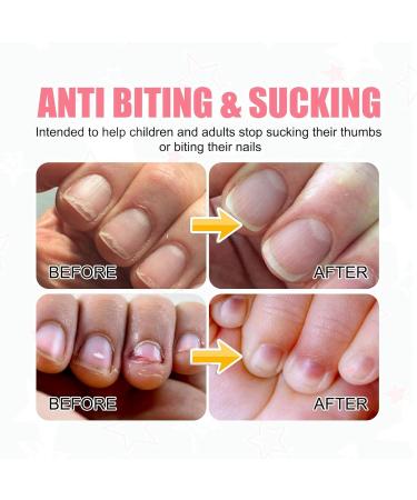 Anti Nail Biting Nail Polish Stop and Grow Nail Biting Stop Nail Biting Stop Biting Nails Nail Biting Prevention Nail Biter Stopper Nail Biting Treatment Clear Nail Varnish Safe Natural Plant Extract - Buy Online on SooperMarket.com