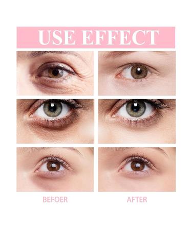 2Pcs Retinol Eye Stick Set - Anti-Aging Eye Cream for Dark Circles & Puffiness - Reduces Fine Lines, Wrinkles & Dark Circles - Eye Balm Stick Serum - Buy Online on SooperMarket.com