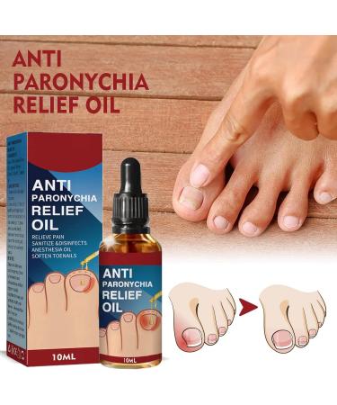 Ingrown Toenail Treatment Correction Drops Nail Growth Treatment Nail Care Ingrowing Toenail Treatment Ingrown Toenail Corrector Treatment for Ingrown Toenail Ingrowing Toenail Improve Toenail Health - Buy Online on SooperMarket.com