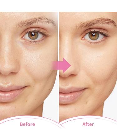 Silicone Face Mask Cover & Ice Face Mask Set | Cooling Relief for Dark Circles Puffiness Migraines | Reusable Anti-Wrinkle Holder - Pink - Buy Online on SooperMarket.com