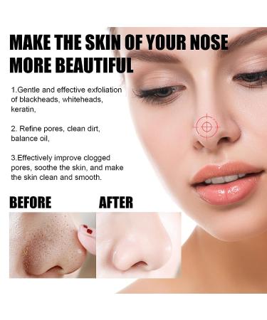 Pro-Herbal Refining Peel-Off Facial Mask Set - Blackhead Remover & Pore Cleansing Skincare - Buy Online on SooperMarket.com