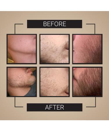 Beard Growth Kit - 30 Day Supply | Beard Growth Oil & Roller for Fuller Beards - Buy Online on SooperMarket.com