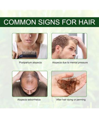 Rosemary Oil for Hair Growth & Loss Regrowth Treatment - 2.02 oz | Strengthens, Nourishes Scalp, Improves Circulation - Men & Women - Buy Online on SooperMarket.com