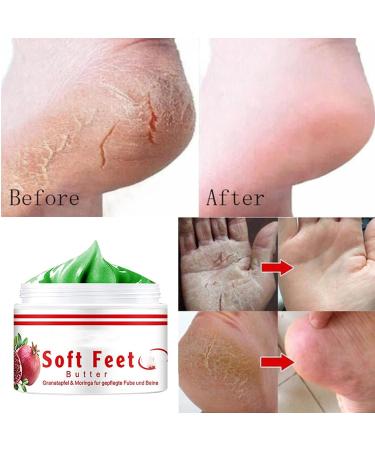 Pomegranate Hand and Foot Cream | Repair Dry Cracked Heels & Chapped Skin | Moisturizing Salve with Pomegranate Extract & Peppermint | International Shipping Available - Buy Online on SooperMarket.com
