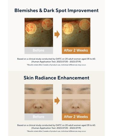 AROMATICA Glow Vita C Toning Serum - Orange & Neroli | Vitamin C Serum for Sensitive Skin | 30ml | Boost Radiance & Hydration - Buy Online on SooperMarket.com