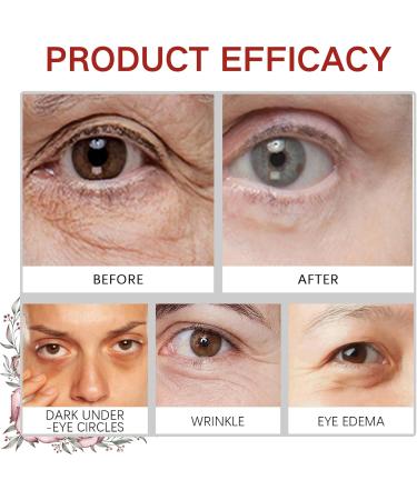 Rose Eye Cream Under Eye Cream for Dark Circles Eye Bags Remover Hydrating Eye Cream Rose Eye Cream Anti Aging Dark Circles Under Eye Treatment For Puffy Eyes Fine Lines Firming & Brightening - Buy Online on SooperMarket.com