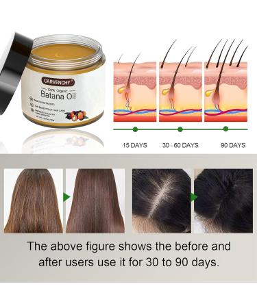 Dr. Sebi Batana Oil - 100% Pure Hair Growth Oil | Unrefined Hair Loss Prevention & Thickness Enhancer for Men & Women | 4.23 OZ - Buy Online on SooperMarket.com