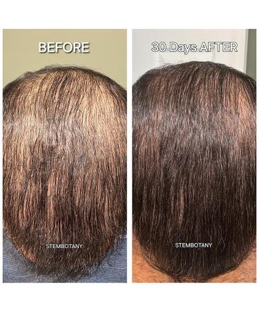 GHK-cu Copper Peptide Hair Regrowth Shampoo for Men & Women - Boost Hair Growth Nourish & Revitalize Shop Internationally - Buy Online on SooperMarket.com