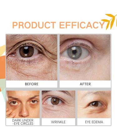 Turmeric Eye Cream Turmeric Under Eye Cream for Dark Circles Eye Bags Remover Under Eye Brightener Eye Cream Anti Aging For Puffy Eyes Dull Eye Skin Fine Lines Firming Hydrating Moisturizing - Buy Online on SooperMarket.com