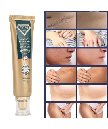 Silicone Scar Ointment 30g - Moisturizing Scar Cream for Smooth, Inconspicuous Scar Removal - Buy Online on SooperMarket.com