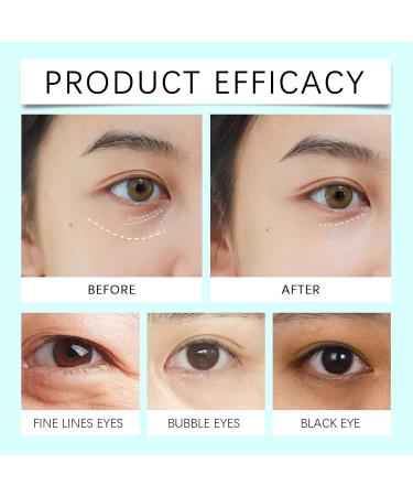 Reparative Eye Cream Anti Aging Under Eye Cream for Wrinkles & Fine Lines Reparative Eye Cream for Dark Circles and Puffy Eyes Eye Repair Cream Moisturising Cream for Eyes Firming Brightening - Buy Online on SooperMarket.com