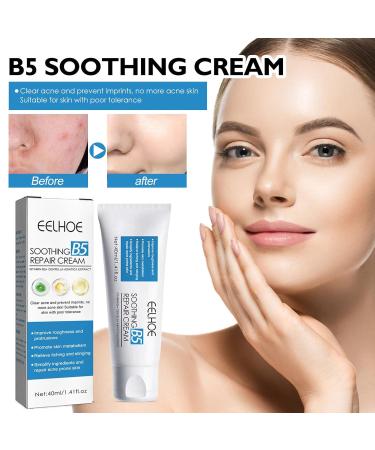 B5 Soothing Repairing Cream - Strengthen Skin Barrier Repair Acne-Prone Skin Improve Roughness | 40ml - International Shipping Available - Buy Online on SooperMarket.com