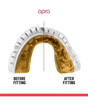 OPRO Gold Level DASS Control Mouthguard | Premium Sports Mouth Protection for Boxing Handball Martial Arts & Hockey - White - Buy Online on SooperMarket.com