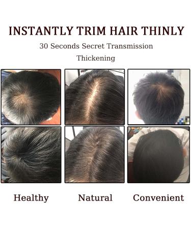 Hair Fibres Dark Brown Hair Volume Powder Natural Formula Hair Thickening Spray Hair Loss Treatment for Men & Women Instantly Conceals Hair Loss Unisex Hair Building Fibres for Bald Spots - Buy Online on SooperMarket.com