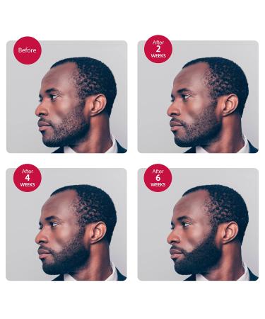 Godefroy Thick Beard and Mustache Growth Serum for Ethnic Hair Types 15ml - Promotes Thicker Hair Growth for Ethnic Hair - Buy Online on SooperMarket.com
