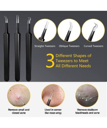 Blackhead Remover Pimple Popper Tool Kit - 19 Pcs Professional Extractor Set for Face and Nose - Stainless Steel Comedone and Whitehead Extractor with Metal Case (Black) - Buy Online on SooperMarket.com