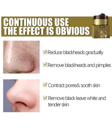 Pro-Herbal Refining Peel-Off Facial Mask Set - Blackhead Remover & Pore Cleansing Skincare - Buy Online on SooperMarket.com