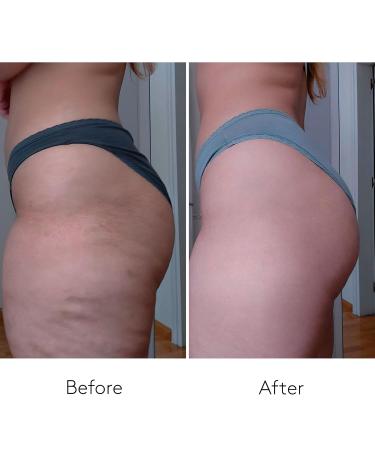 COCUNAT Body Power Anti-Cellulite Slimming Cream - Redefine Your Silhouette (150 ml + 125 ml) - International Shipping Available - Buy Online on SooperMarket.com